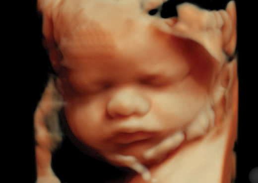 34 week 4d ultrasound pictures